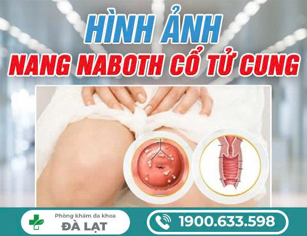 Hình ảnh minh họa